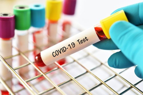 Loại thuốc thử xét nghiệm chẩn đoán nhanh loại mới Covid-19 ở Singapore